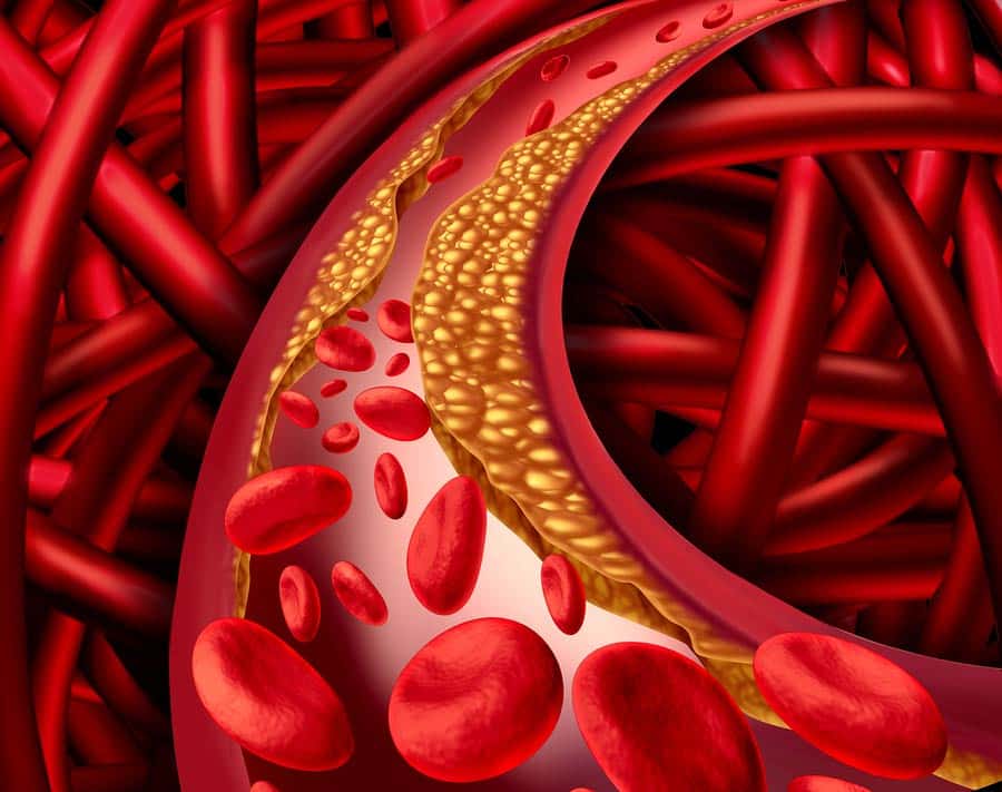 cholesterol-reishi